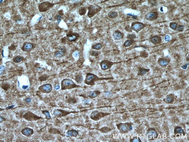 MAP1B Polyclonal Antibody (21633-1-AP)