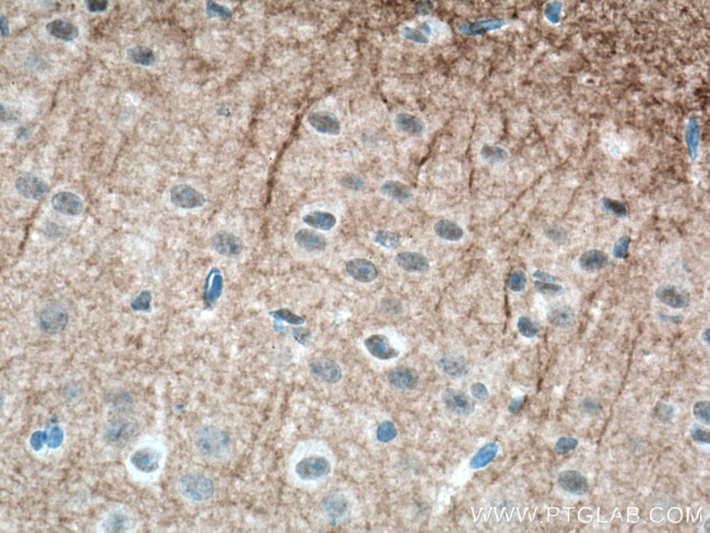 GIRK2 Antibody in Immunohistochemistry (Paraffin) (IHC (P))