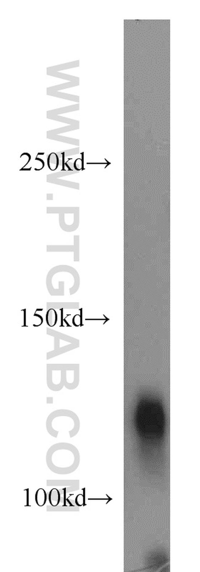 SLITRK3 Antibody in Western Blot (WB)