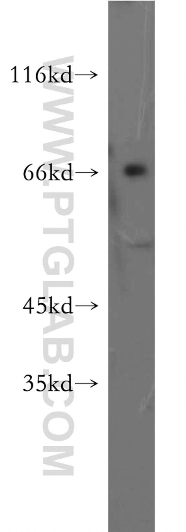 ZNF192 Antibody in Western Blot (WB)