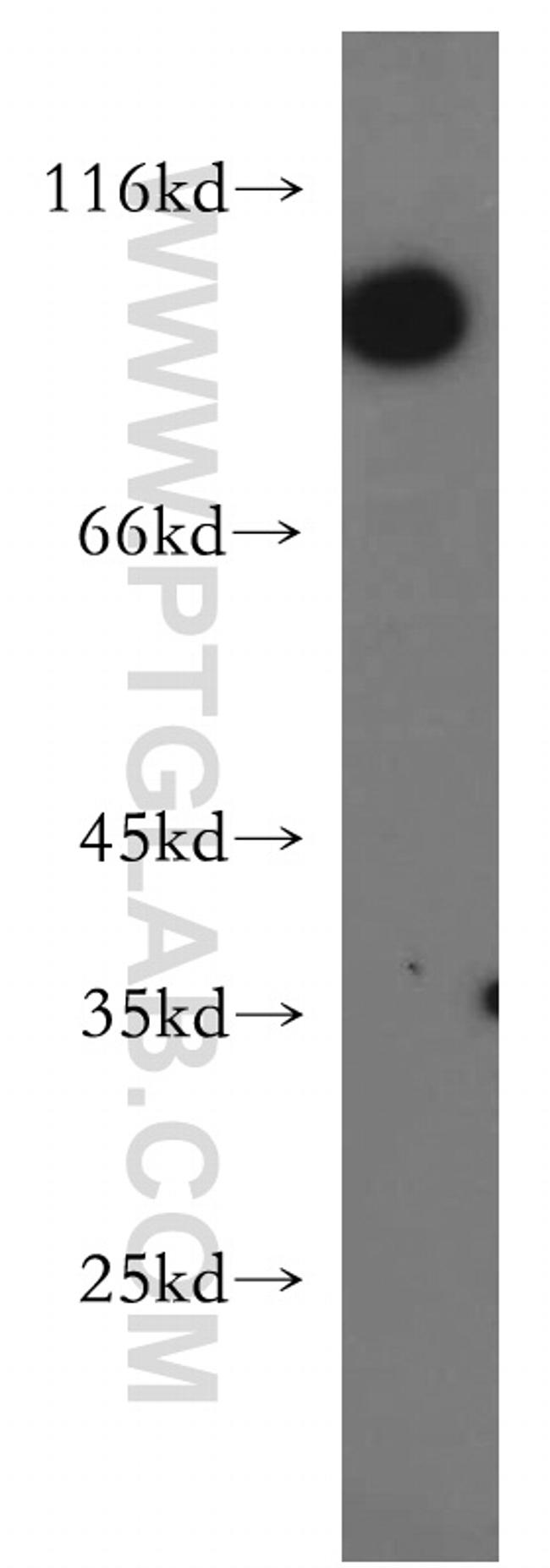 CNGA3 Antibody in Western Blot (WB)
