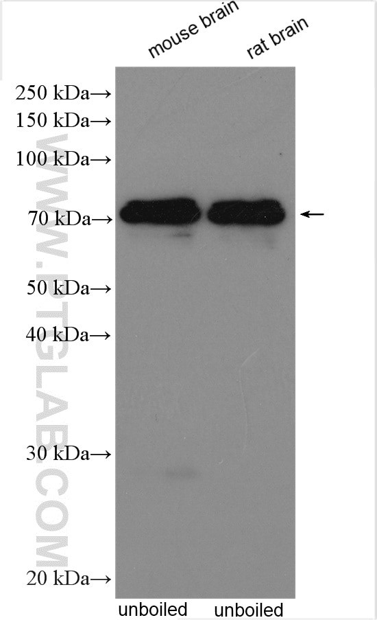 KCNA5 Antibody in Western Blot (WB)