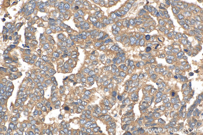 ATP5G3 Antibody in Immunohistochemistry (Paraffin) (IHC (P))