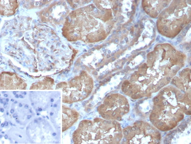 FABP1/Fatty Acid Binding Protein 1 Antibody in Immunohistochemistry (Paraffin) (IHC (P))