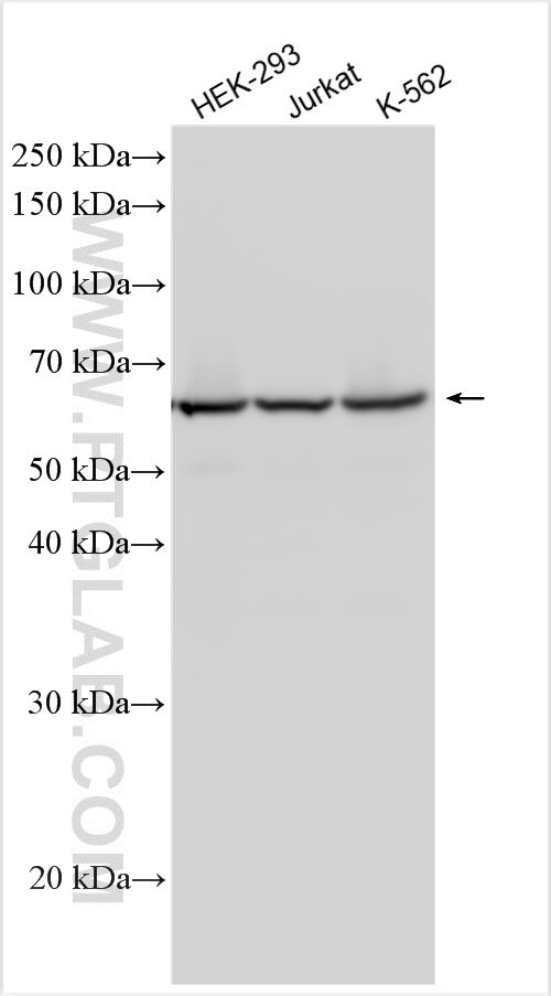 PRMT7 Antibody in Western Blot (WB)