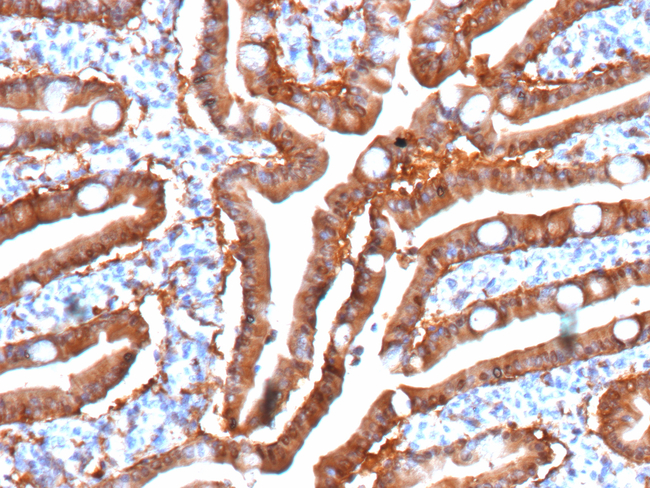 FABP2 (Marker of Metastatic Potential in Colorectal Cancer) Antibody in Immunohistochemistry (Paraffin) (IHC (P))