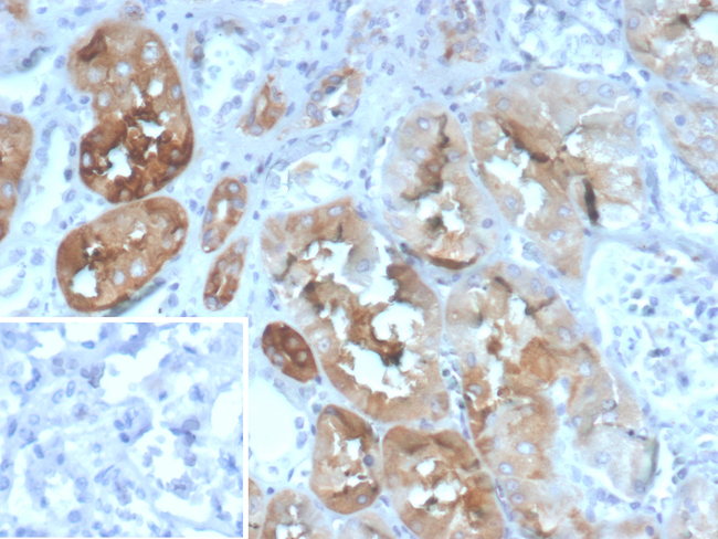 FABP2 (Marker of Metastatic Potential in Colorectal Cancer) Antibody in Immunohistochemistry (Paraffin) (IHC (P))