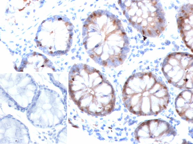 FABP2 (Marker of Metastatic Potential in Colorectal Cancer) Antibody in Immunohistochemistry (Paraffin) (IHC (P))