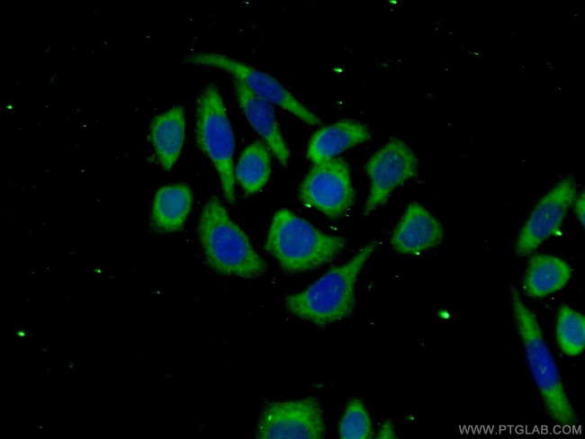 TTC31 Antibody in Immunocytochemistry (ICC/IF)