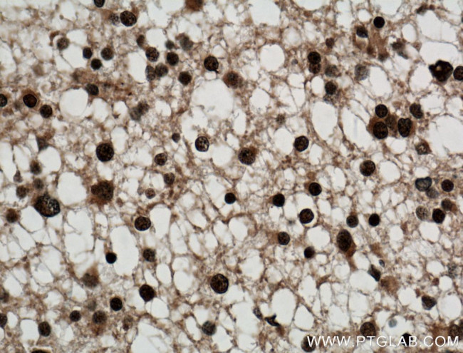 SMC1A Antibody in Immunohistochemistry (Paraffin) (IHC (P))