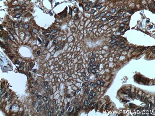 Integrin beta-6 Antibody in Immunohistochemistry (Paraffin) (IHC (P))