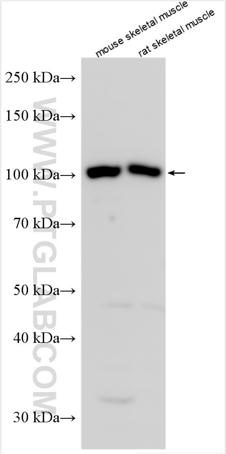 IGF1R Antibody in Western Blot (WB)