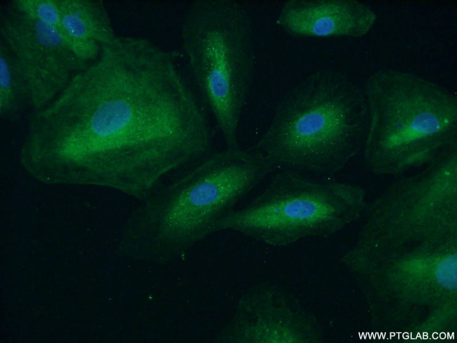 APAF1 Antibody in Immunocytochemistry (ICC/IF)