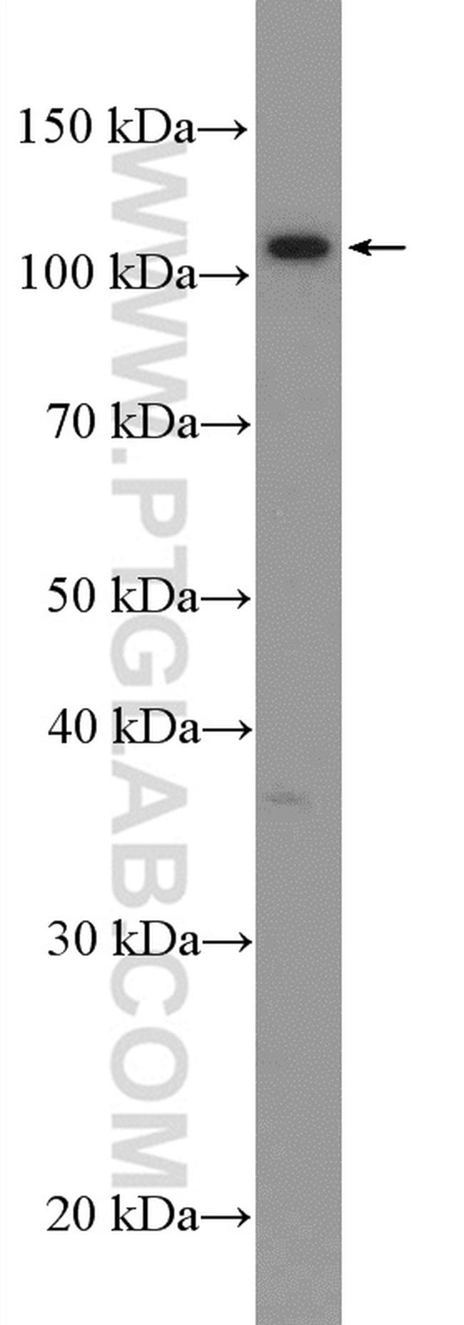 CACNA2D3 Antibody in Western Blot (WB)