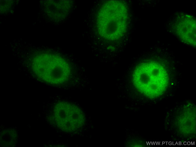 NFAT5 Antibody in Immunocytochemistry (ICC/IF)