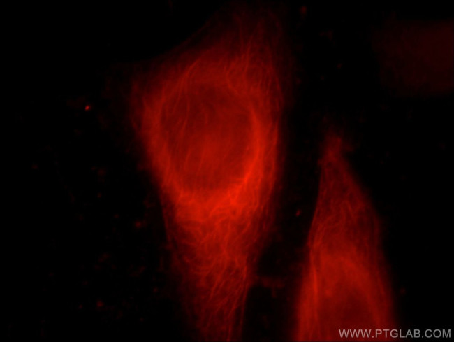 SERPINB10 Antibody in Immunocytochemistry (ICC/IF)