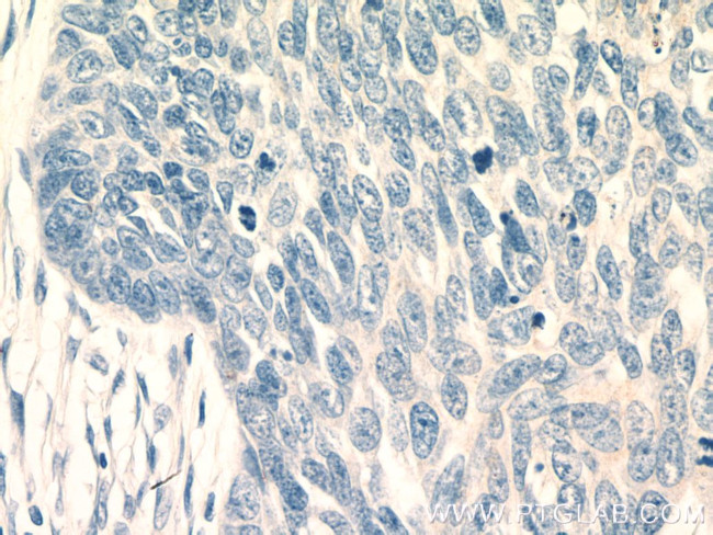 KRT2 Antibody in Immunohistochemistry (Paraffin) (IHC (P))