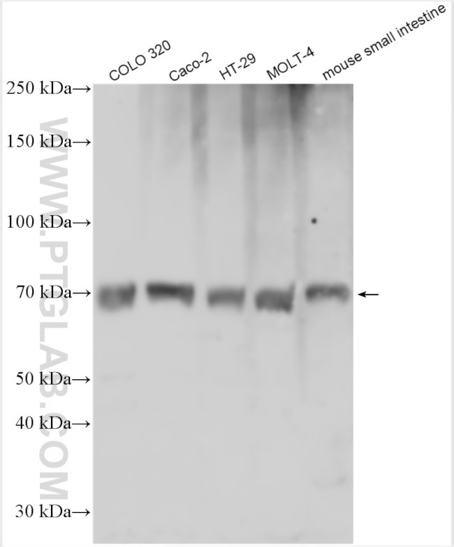 SLC15A1/PEPT1 Antibody in Western Blot (WB)