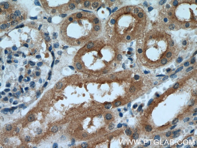 IDE Antibody in Immunohistochemistry (Paraffin) (IHC (P))