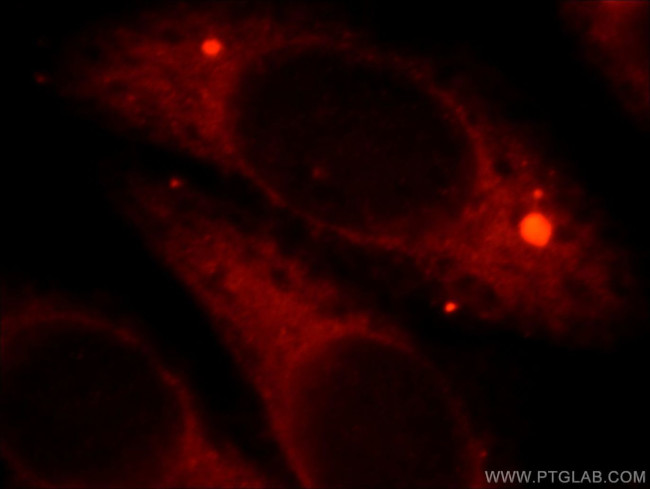 HSPB2 Antibody in Immunocytochemistry (ICC/IF)