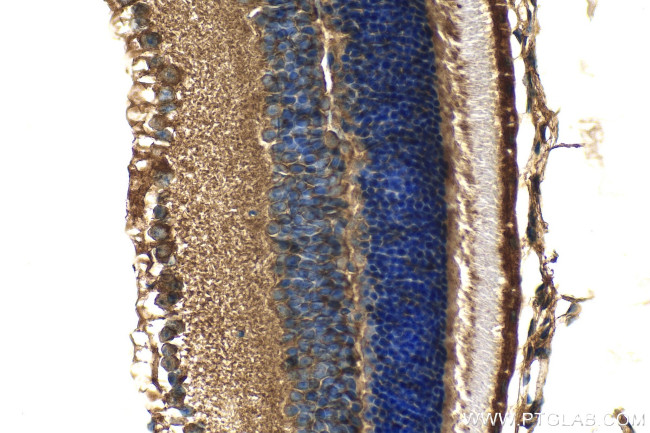 KCNV2 Antibody in Immunohistochemistry (Paraffin) (IHC (P))