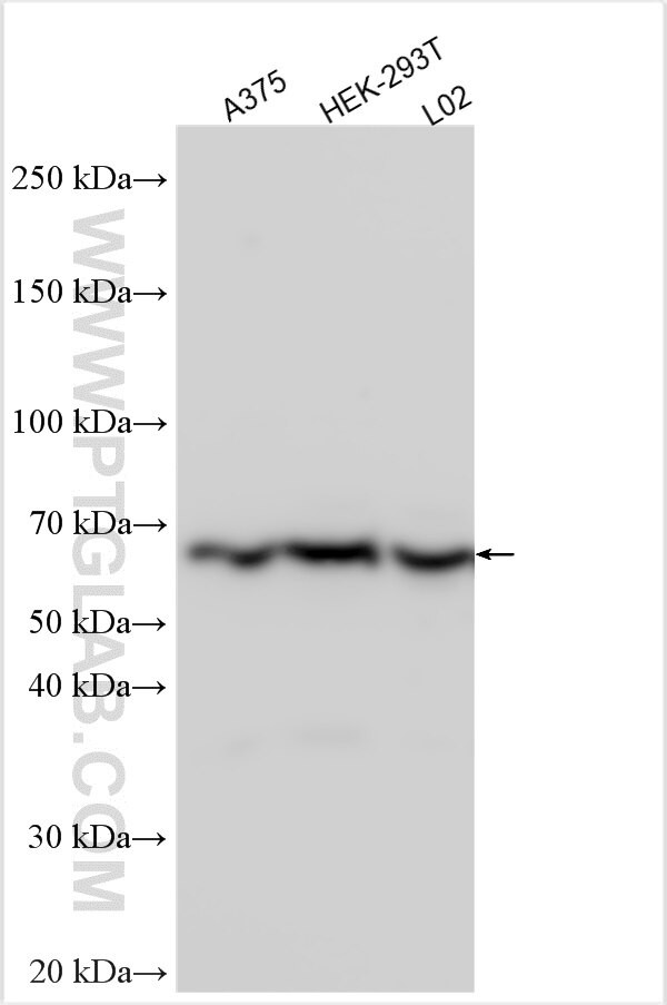 ANAPC7 Antibody in Western Blot (WB)