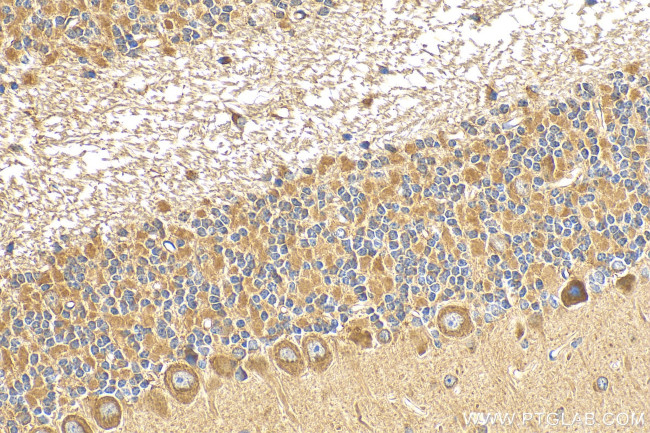 GABRA6 Antibody in Immunohistochemistry (Paraffin) (IHC (P))