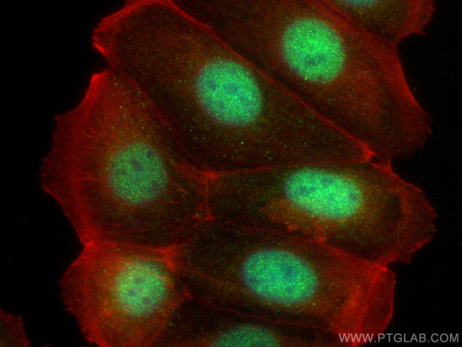 DPF1 Antibody in Immunocytochemistry (ICC/IF)