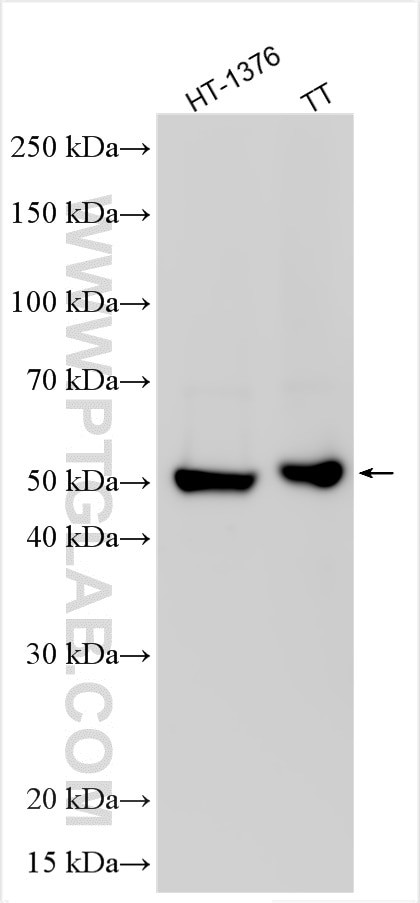 PNMA5 Antibody in Western Blot (WB)