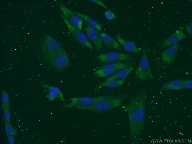 LCE1B Antibody in Immunocytochemistry (ICC/IF)
