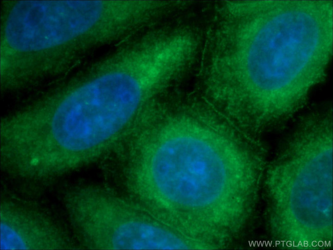 Ataxin 2 Antibody in Immunocytochemistry (ICC/IF)