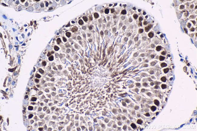 ID4 Antibody in Immunohistochemistry (Paraffin) (IHC (P))