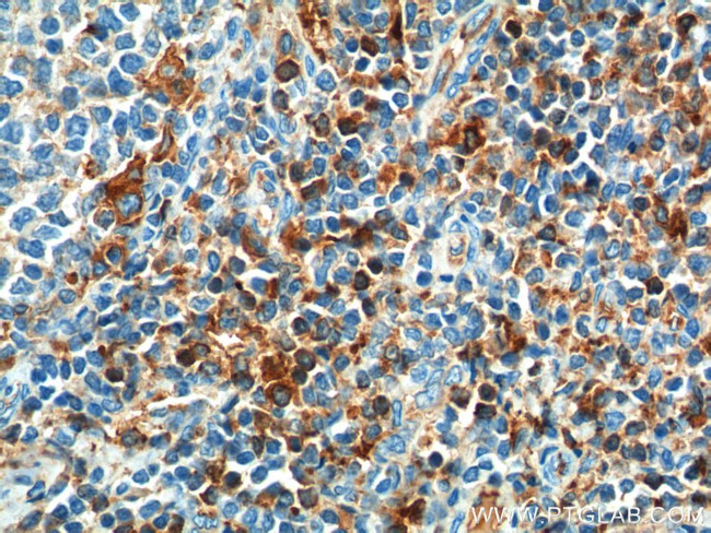 CD52 Antibody in Immunohistochemistry (Paraffin) (IHC (P))