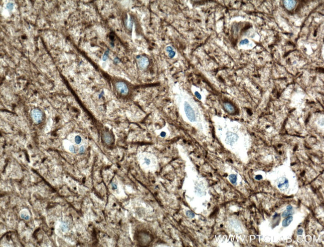CEP152 Antibody in Immunohistochemistry (Paraffin) (IHC (P))