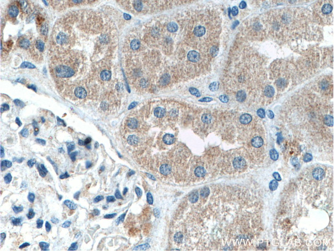 IFRG15 Antibody in Immunohistochemistry (Paraffin) (IHC (P))