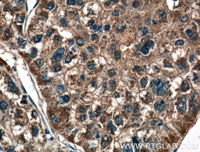 MASP1 Polyclonal Antibody (21837-1-AP)