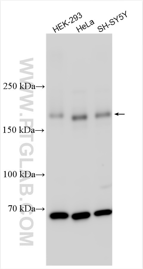 UNC13B Antibody in Western Blot (WB)