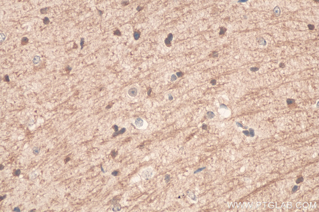 TRPM2 Antibody in Immunohistochemistry (Paraffin) (IHC (P))