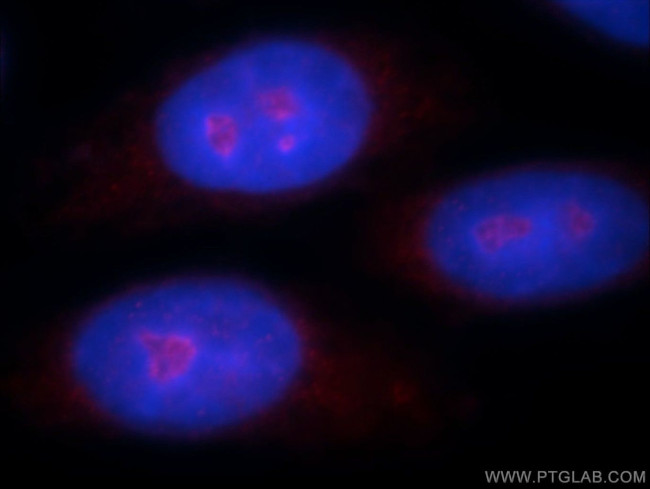 ZNF74 Antibody in Immunocytochemistry (ICC/IF)