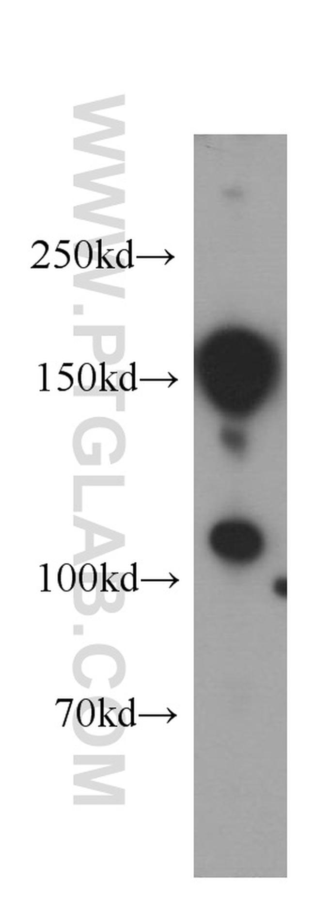 KIDINS220 Antibody in Western Blot (WB)