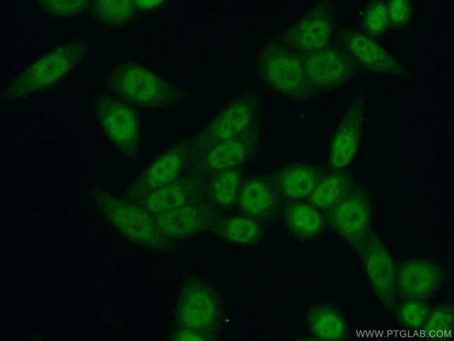 TCERG1 Antibody in Immunocytochemistry (ICC/IF)