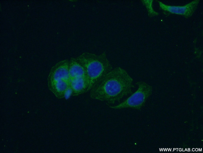 PCDH10 Antibody in Immunocytochemistry (ICC/IF)