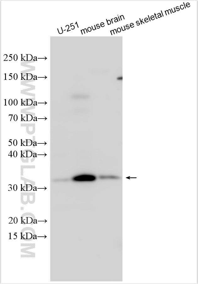 TIGD7 Antibody in Western Blot (WB)