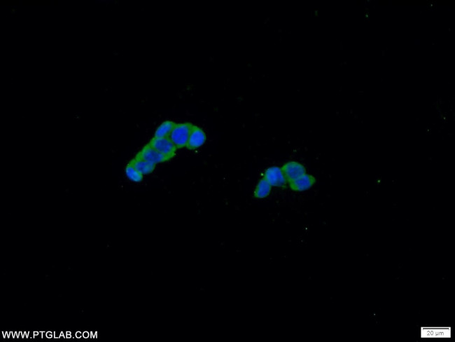 CCHCR1 Antibody in Immunocytochemistry (ICC/IF)