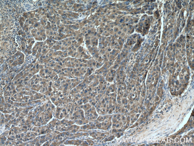 DUS4L Antibody in Immunohistochemistry (Paraffin) (IHC (P))