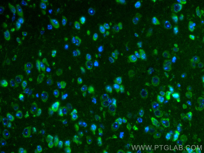 SLC38A9 Antibody in Immunohistochemistry (PFA fixed) (IHC (PFA))