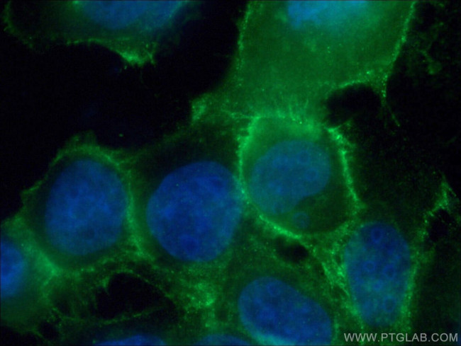 DSG2 Antibody in Immunocytochemistry (ICC/IF)