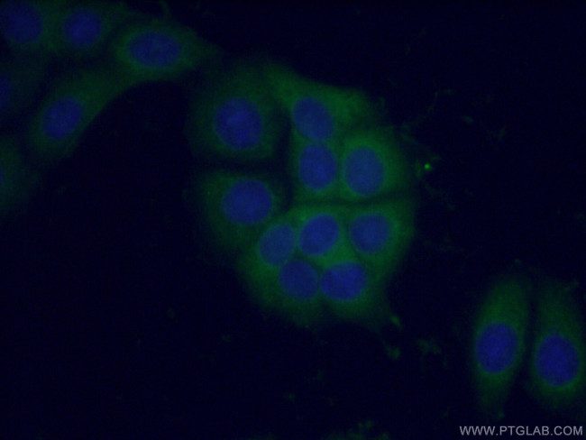 PI3K p110(alpha) Antibody in Immunocytochemistry (ICC/IF)