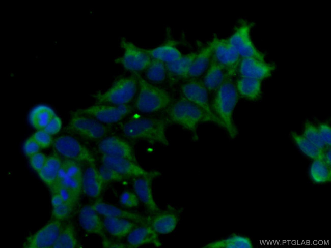 TGF-beta 1 Antibody in Immunocytochemistry (ICC/IF)