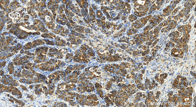 AGMAT Antibody in Immunohistochemistry (Paraffin) (IHC (P))
